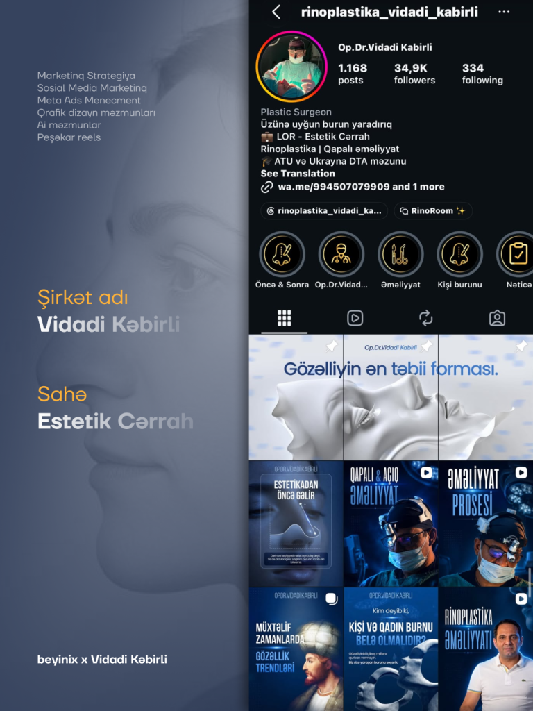 Vidadi Kəbirli — Instagram səhifəsinin Beyinix tərəfindən hazırlanmış dizaynı